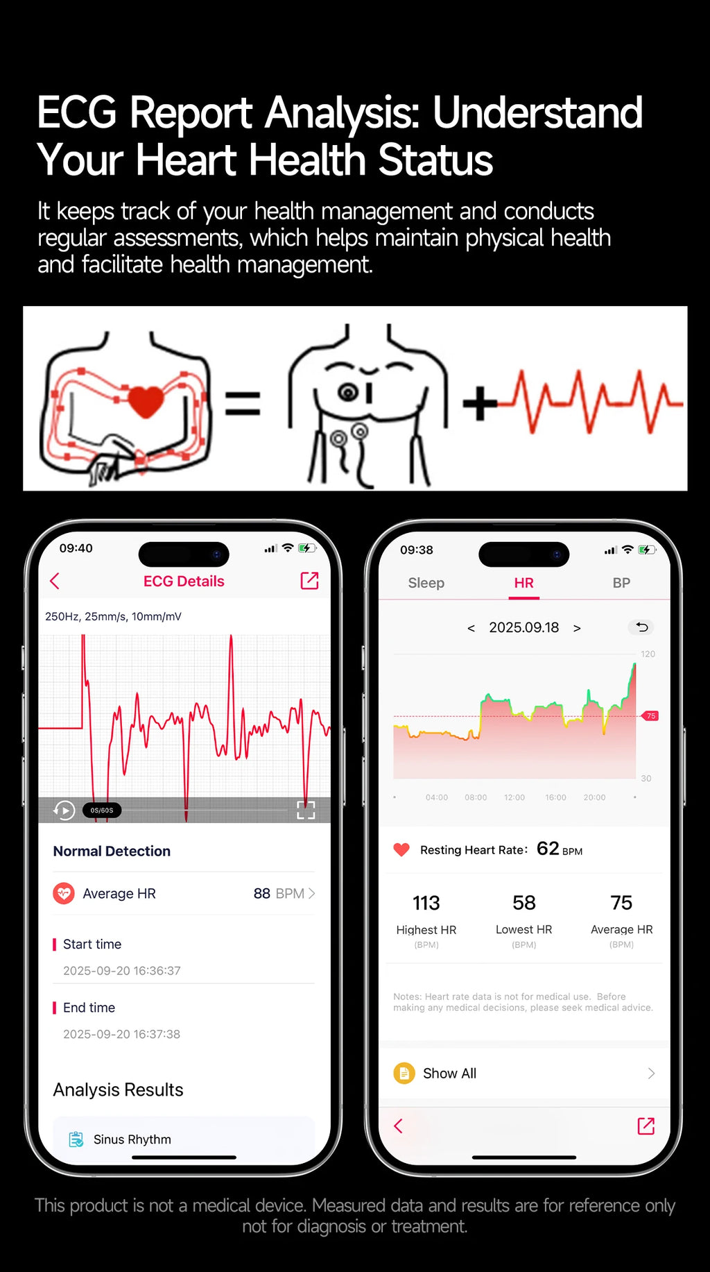2026 New Accurate Diagnosis ECG Smart Watch Body Fat Blood oxygen BP Health Sport HD AMOLED Screen call Smart watch Men women